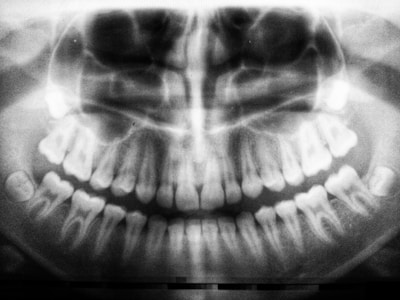 Oral and Maxillofacial Radiology